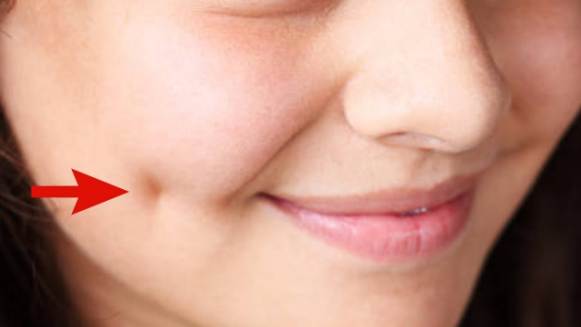 Dimples Benefits How They Are Formed Different Types And Surgery Webbspy