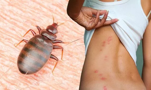 How to Prevent Bed Bugs Naturally or with Spray